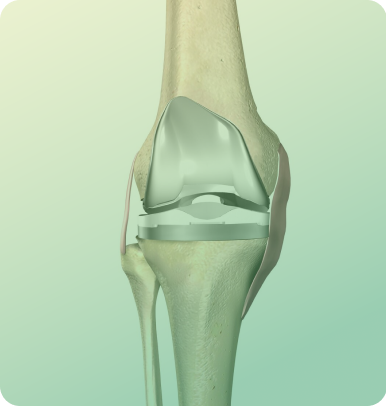 Labral Repair