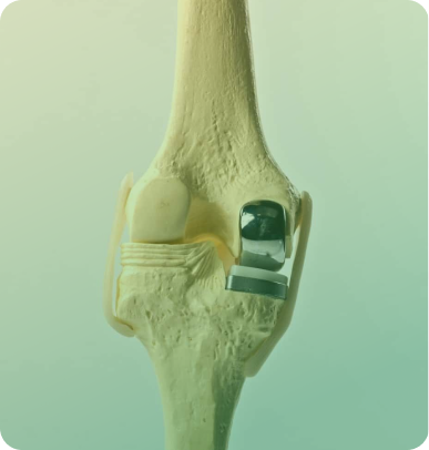 Labral Debridement