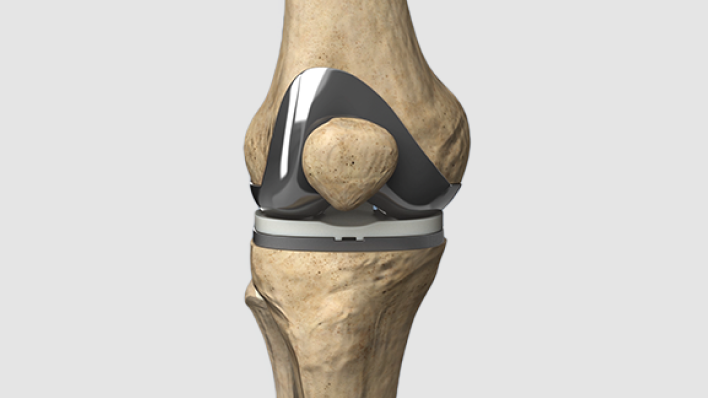hip arthroscopy Dubai