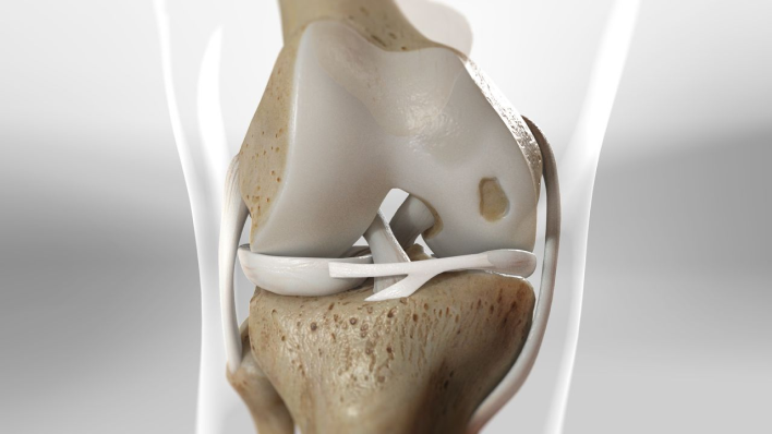articular cartilage injury