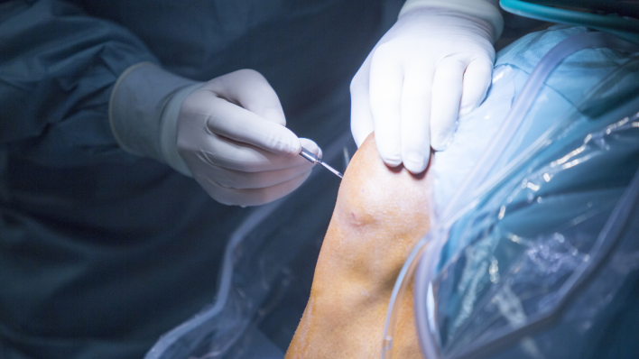 knee arthroscopy dubai