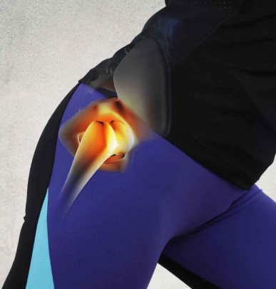 Hip Sprains