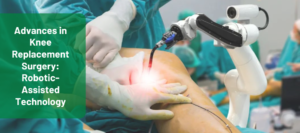 robotic knee replacement