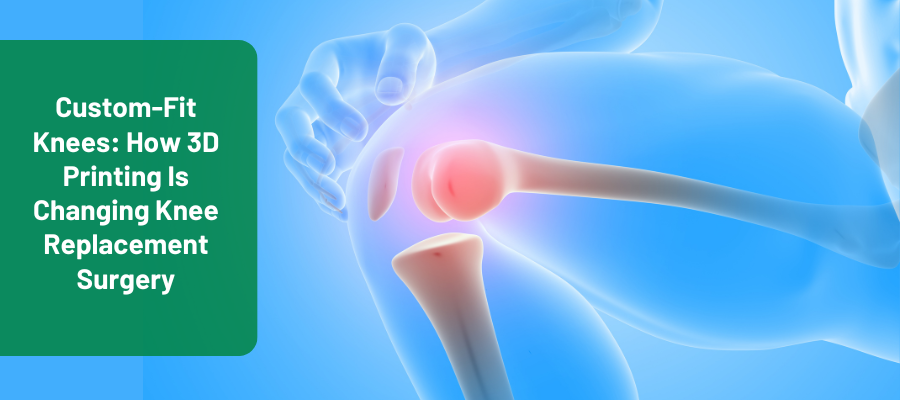 3D printed knee replacement