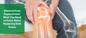 bilateral knee replacement