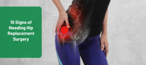 signs of needing hip replacement surgery