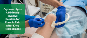 Cryoneurolysis