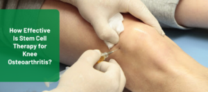 stem cell therapy for knee osteoarthritis