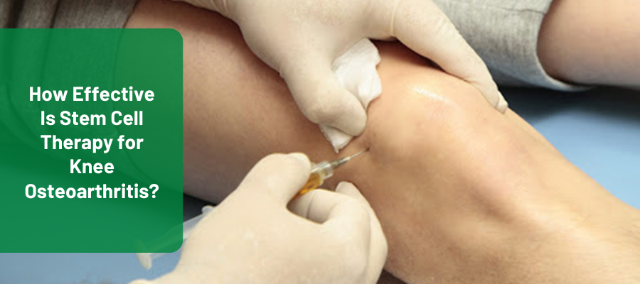 stem cell therapy for knee osteoarthritis