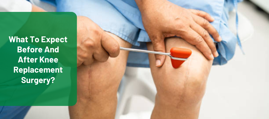 before and after knee replacement surgery