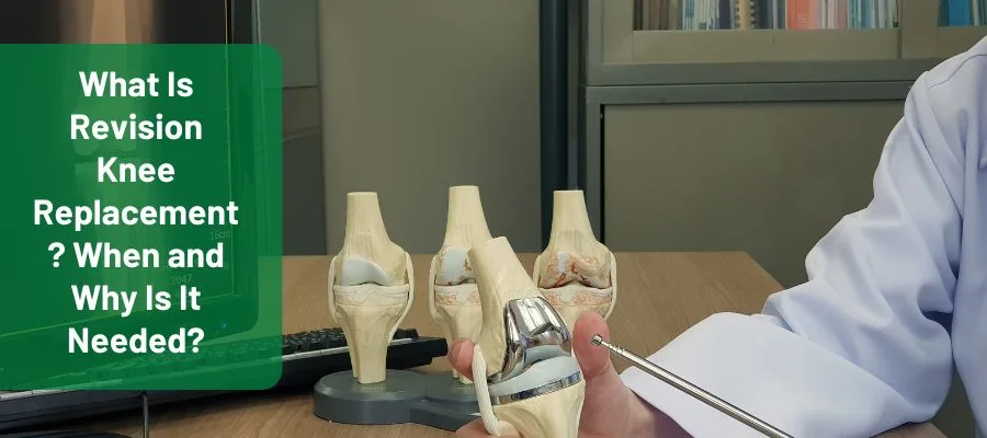 revision knee replacement